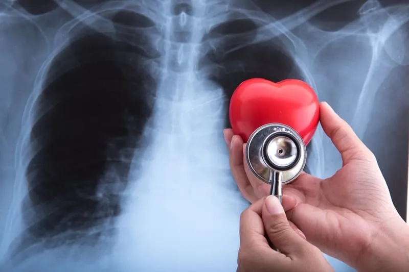 Avances en el Diagnóstico y Tratamiento de Tumores Cardiacos y Pulmonares